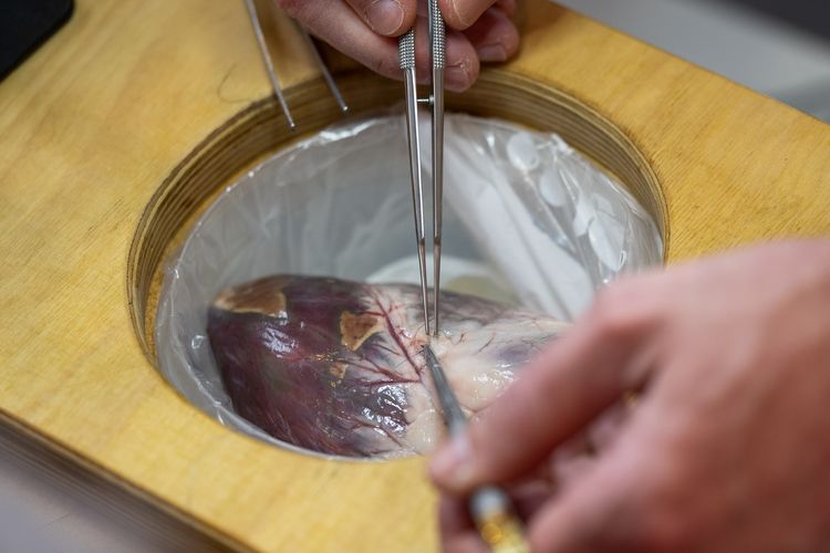 Nahaufnahme einer OP-Situation am Schweineherzen.