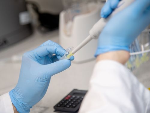 Zwei Hände in blauen Handschuhen pipettieren im Labor eine Flüssigkeit.