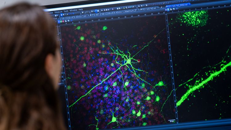 Eine Frau sitzt vor einem Monitor auf dem gründe und rote Punkte unterschiedlich stark leuchten.